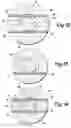 Fig. 09 - Spoke wheel protector