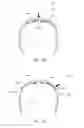Fig. 29 - Floating lens mounting system