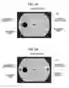 Fig. 03 - Eye fundus camera