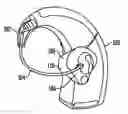 Fig. 01 - Cable length adjustment in auditory devices
