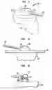 Fig. 03 - Cable length adjustment in auditory devices