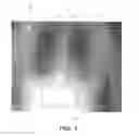 Fig. 02 - Automated quantification of digital radiographic image quality