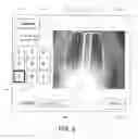 Fig. 07 - Automated quantification of digital radiographic image quality