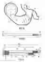 Fig. 02 - Electrical heating device, particularly for an automobile vehicle