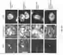 Fig. 02 - Methods for determining aged based accumulation of senescent cells using senescence specific DNA damage markers