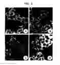 Fig. 06 - Diagnostic method for diseases by screening for hepcidin in human or animal tissues, blood or body fluids and therapeutic uses therefor