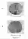 Fig. 12 - TrkB Agonists for Treating Autoimmune Disorders