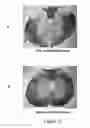 Fig. 15 - TrkB Agonists for Treating Autoimmune Disorders