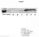 Fig. 08 - Products and methods using soy peptides to lower total and LDL cholesterol levels
