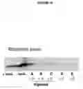 Fig. 11 - Products and methods using soy peptides to lower total and LDL cholesterol levels