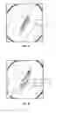 Fig. 02 - Colon polyp staging methods