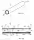 Fig. 10 - Apparatus and methods for making coated liners and tubular devices including such liners