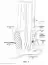 Fig. 02 - Sphincter treatment apparatus