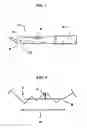 Fig. 02 - METHODS FOR AMELIORATING TISSUE TRAUMA FROM  SURGICAL INCISIONS
