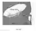 Fig. 05 - COMPOSITIONS AND METHODS FOR USE OF ALGINATE DURAL SEALANTS