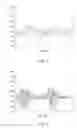 Fig. 07 - COMPOSITIONS AND METHODS FOR USE OF ALGINATE DURAL SEALANTS