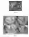 Fig. 08 - COMPOSITIONS AND METHODS FOR USE OF ALGINATE DURAL SEALANTS