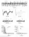 Fig. 09 - Method and apparatus for measuring and treating shivering during therapeutic temperature control