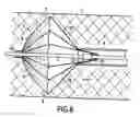 Fig. 06 - Apparatus and methods for stent delivery with embolic protection