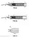 Fig. 07 - Apparatus and methods for stent delivery with embolic protection