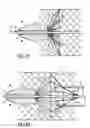 Fig. 08 - Apparatus and methods for stent delivery with embolic protection