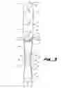 Fig. 04 - Floor span connector