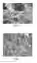 Fig. 02 - Dental filler and methods