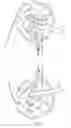 Fig. 17 - Archery bow with force vectoring anchor
