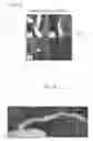 Fig. 16 - Medical image processor and medical image processing method