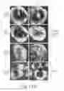 Fig. 10 - Nicotine immunonanotherapeutics