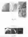 Fig. 16 - Nicotine immunonanotherapeutics