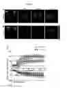 Fig. 11 - Prevention of tissue ischemia, related methods and compositions
