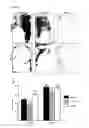 Fig. 12 - Prevention of tissue ischemia, related methods and compositions