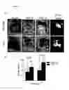 Fig. 17 - Prevention of tissue ischemia, related methods and compositions