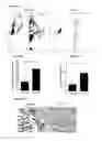 Fig. 26 - Prevention of tissue ischemia, related methods and compositions