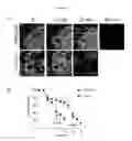 Fig. 44 - Prevention of tissue ischemia, related methods and compositions