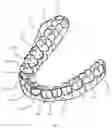 Fig. 01 - Method And System For Deriving A Common Coordinate System For Virtual Orthodontic Brackets