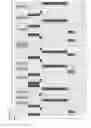 Fig. 02 - Genetic diagnosis using multiple sequence variant analysis