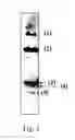 Fig. 02 - L-cysteine producing microorganism and a method for producing L-cysteine