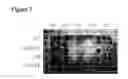 Fig. 04 - BIOTECHNICAL AND MICROBIOLOGICAL PRODUCTION METHOD AND EQUIPMENT