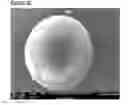 Fig. 04 - Microcarriers for Stem Cell Culture