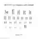 Fig. 175 - Microcarriers for Stem Cell Culture