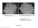 Fig. 190 - Microcarriers for Stem Cell Culture