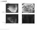 Fig. 55 - Microcarriers for Stem Cell Culture