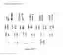 Fig. 96 - Microcarriers for Stem Cell Culture