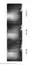 Fig. 16 - Single cell microinjection using flexible and compliant fluidic channels and electroosmotic dosage control