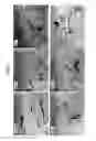 Fig. 08 - Tooth Regeneration Method
