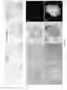 Fig. 02 - METHOD AND KIT FOR EFFICIENT REPROGRAMMING OF SOMATIC CELLS
