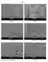 Fig. 06 - Manufacturing three-dimensional scaffolds using electrospinning at low temperatures