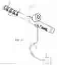 Fig. 02 - Methods and devices for taking multiple biopsy samples from the esophagus